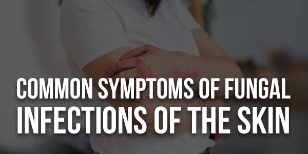 Common-Symptoms-Of-Fungal-Infections-Of-The-Skin