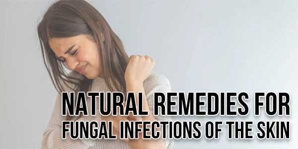 Natural-Remedies-For-Fungal-Infections-Of-The-Skin