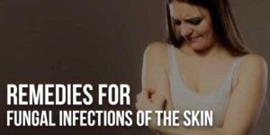 Remedies-For-Fungal-Infections-Of-The-Skin