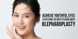 Achieve-Youthful-Eyes-Everything-You-Need-To-Know-About-Blepharoplasty